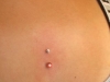 surface dekollete piercing