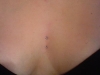 surface dekollete piercing