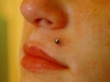oberlippe-asym2.jpg