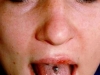 Piercing Zunge